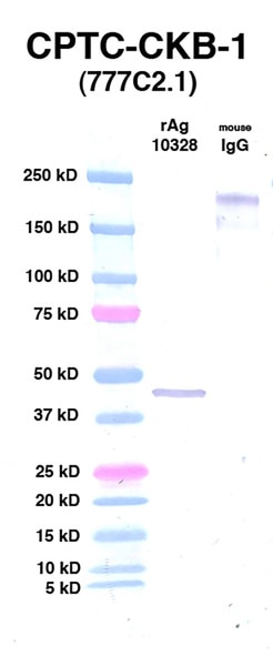 WB using DSHB antibody CPTC-CKB-1 against CKB (Ag 10328) (lane 2). Lane 1 is MW standards. Lane 3 is mouse IgG as controntrol. Image credit: NCL Clinical Proteomic Technologies for Cancer. 